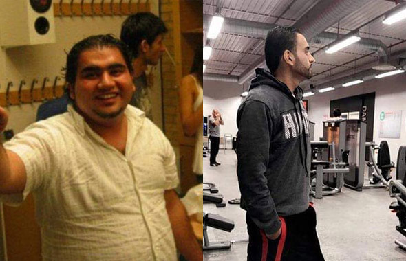 Gastric Sleeve Before and After 3 Months