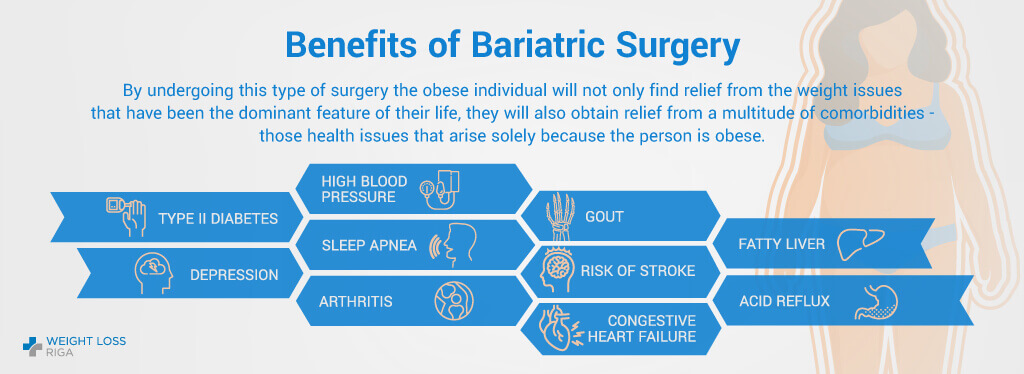 Benefits of Bariatric Surgery Abroad with Weight Loss Riga