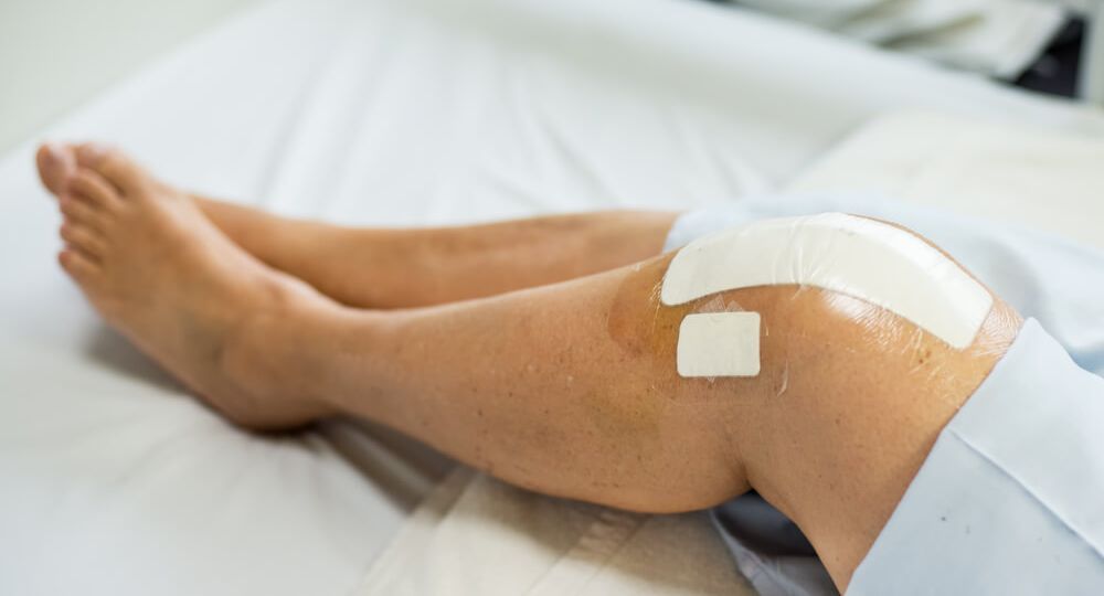bariatric surgery abroad-weight loss riga