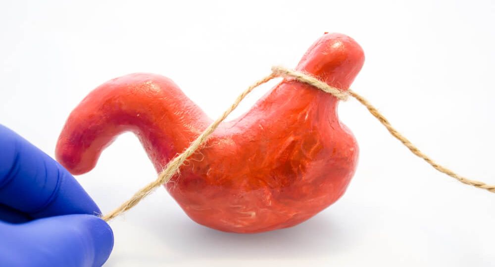Can Weight Loss Surgery Abroad Prolong your Lifespan?